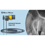 Xpect Vision Digital Dental Imaging Sensor – Size 1.5