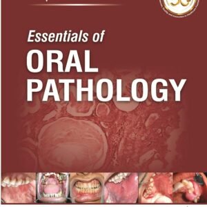 Essentials of Oral Pathology by Swapan Kumar Purkait