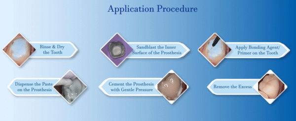 Prevest DenPro Fusion Ultra DC - Image 2