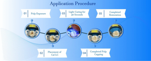 Prevest DenPro Cal LC - Image 2